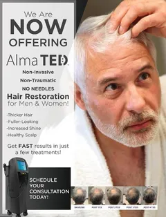 AlmaTED Non Invasive Hair Restoration