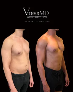 We use state-of-the-art devices and innovative techniques to ensure safe, effective, and lasting results tailored to your unique needs.