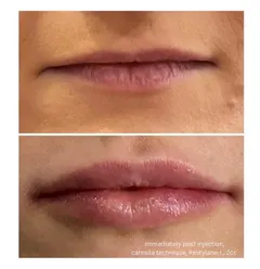 Subtle enhancements are crafted to look effortlessly natural and refined. Your transformation remains your well-kept secret, revealing only refreshed confidence.