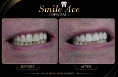 Before and After: Your Smile is Our Passion