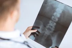 The Saville Spine Institute - Dr. Reviewing X-Ray Results with Patient.