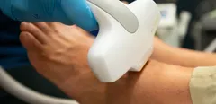 Boca Podiatry Group offers various laser treatment options to address different patient concerns; offering IPL Laser treatments for hair removal, Cutera Laser treatments for spider veins, and MLS Laser is available for acute and chronic pain.
