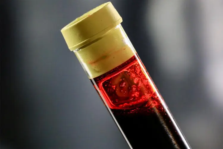 photo of blood vial taken for antinuclear antibody testing if you already have symptoms of an autoimmune conditon