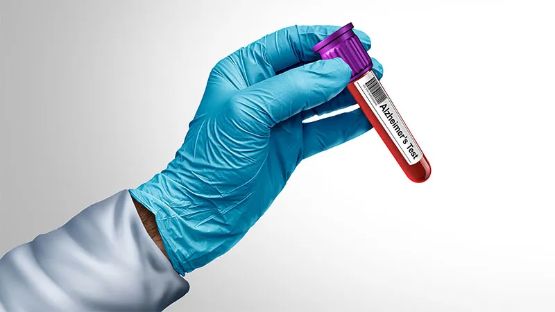 Plasmar Trial: Early Alzheimer's Biomarker Results Increase Diagnostic Certainty