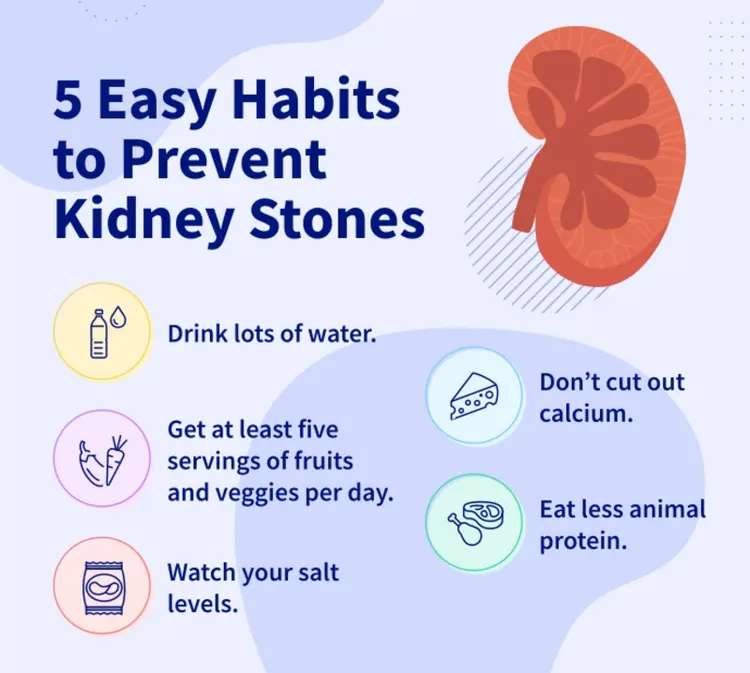 infographic on kidney stone prevention