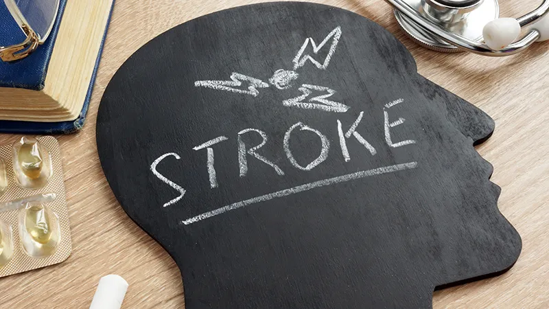 Finnish Study Links Oral Anticoagulation to Lower Stroke Risk