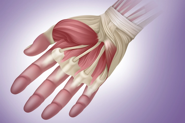 Tendon Release Surgery