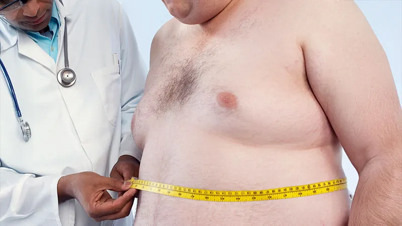 Low Testosterone in Klinefelter Syndrome Identified by Waist Circumference