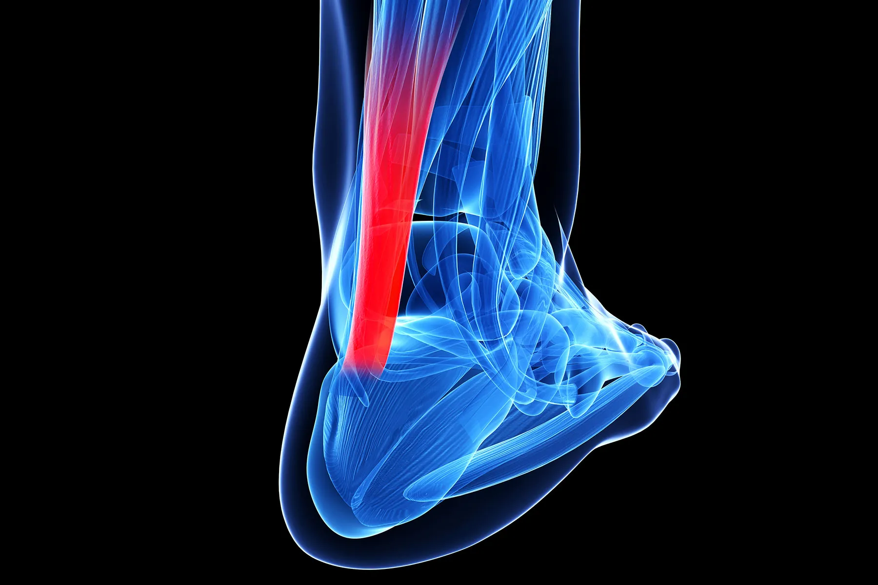 photo of achilles tendon