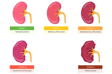 The stages of kidney disease are based on your estimated glomerular filtration rate (eGFR), which is a measure of your kidney's ability to filter. Your GFR corresponds to the percentage of kidney function. The kidney disease stages range from 1 to 5. (Photo credit: iStock/Getty Images)
