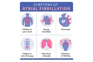 photo of Atrial Fibrillation