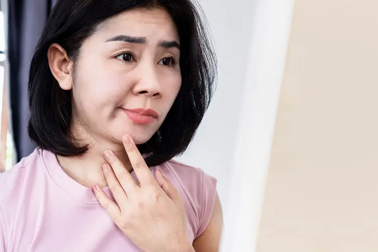 photo of woman with Bell's Palsy