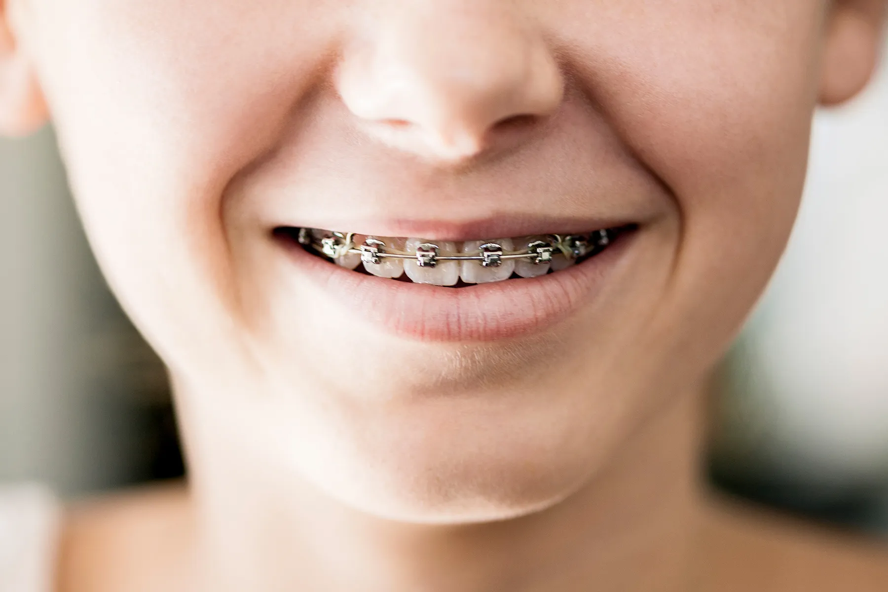 photo of Close-up of a girl smiling