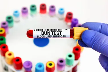 A BUN test measures how much blood urea nitrogen is in your body. It can help discover if there's a problem with your kidneys or liver. (Photo credit: Angellodeco/Dreamstime)
