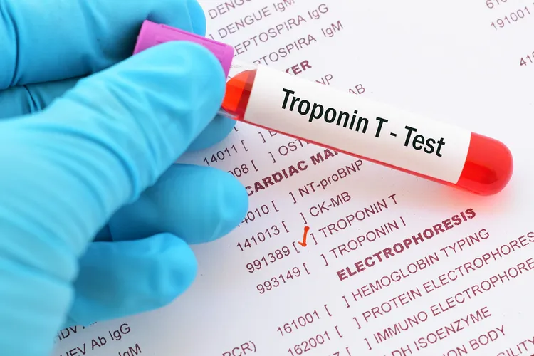 photo of troponin test