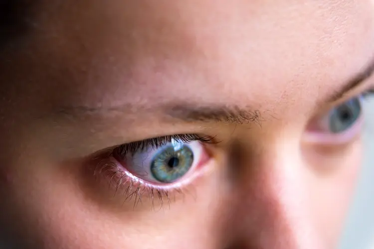 photo of woman with bulging eyes