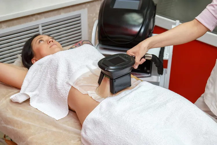 photo of woman getting CoolSculpting treatment