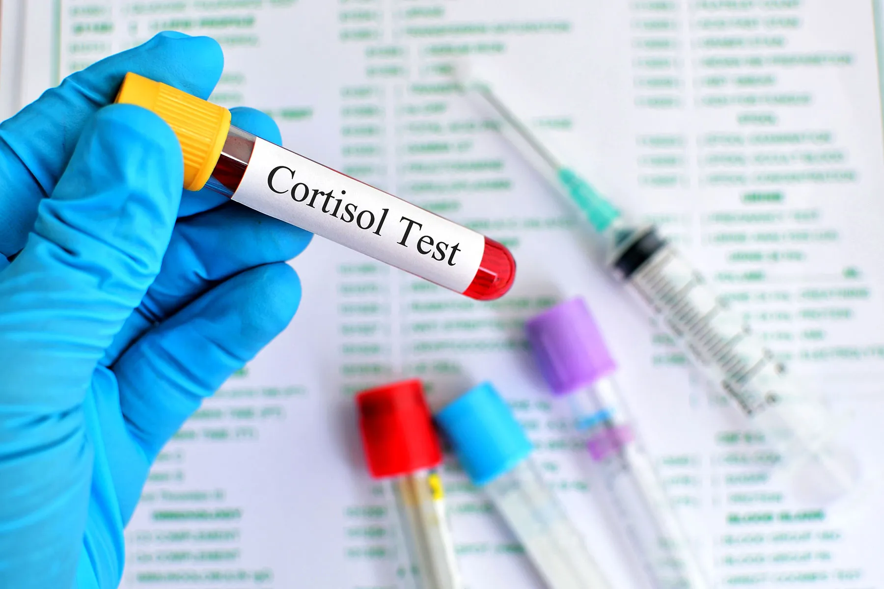 photo of cortisol hormone test