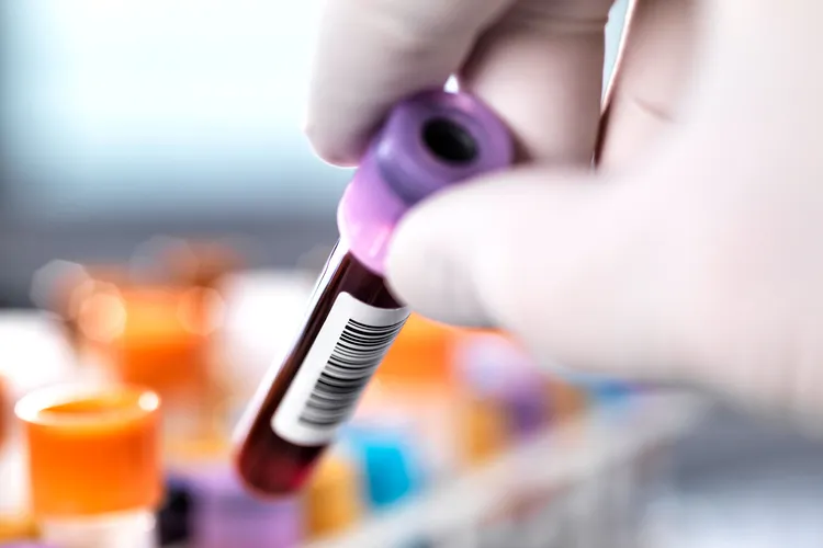 photo of Researcher taking blood sample from rack