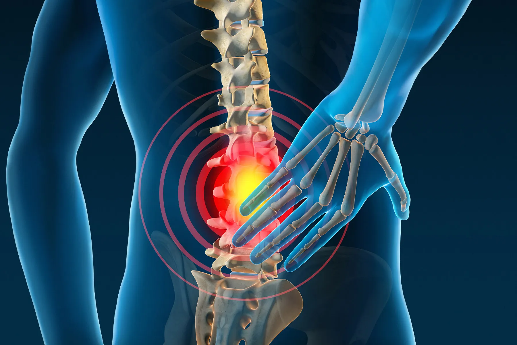 Degenerative Spine