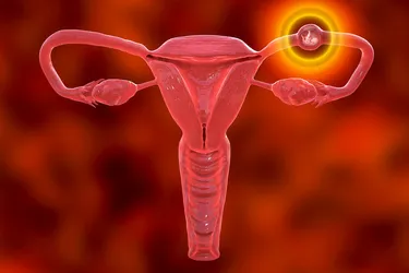 Ectopic pregnancy happens when a fertilized egg implants itself outside of the womb, such as in a fallopian tube. A look at the symptoms of the condition and how doctors treat it. (Photo Credit: Science Photo Library/Getty Images)