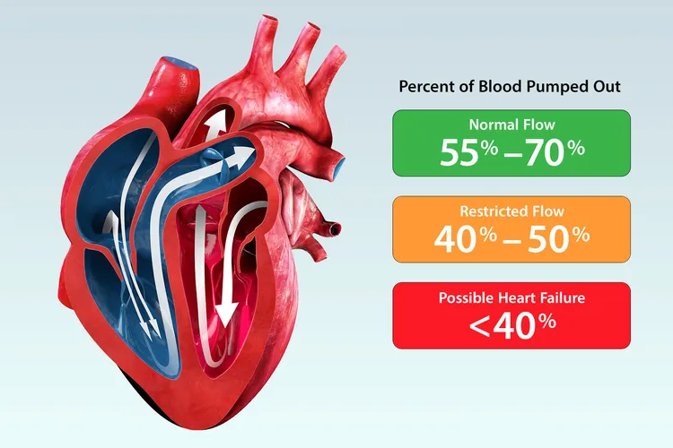 ejection fraction infographic