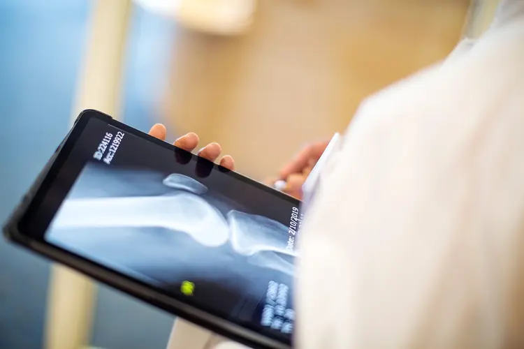 photo of knee xray