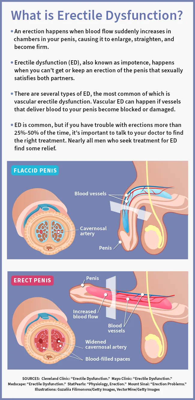 Erectile Dysfunction infographic