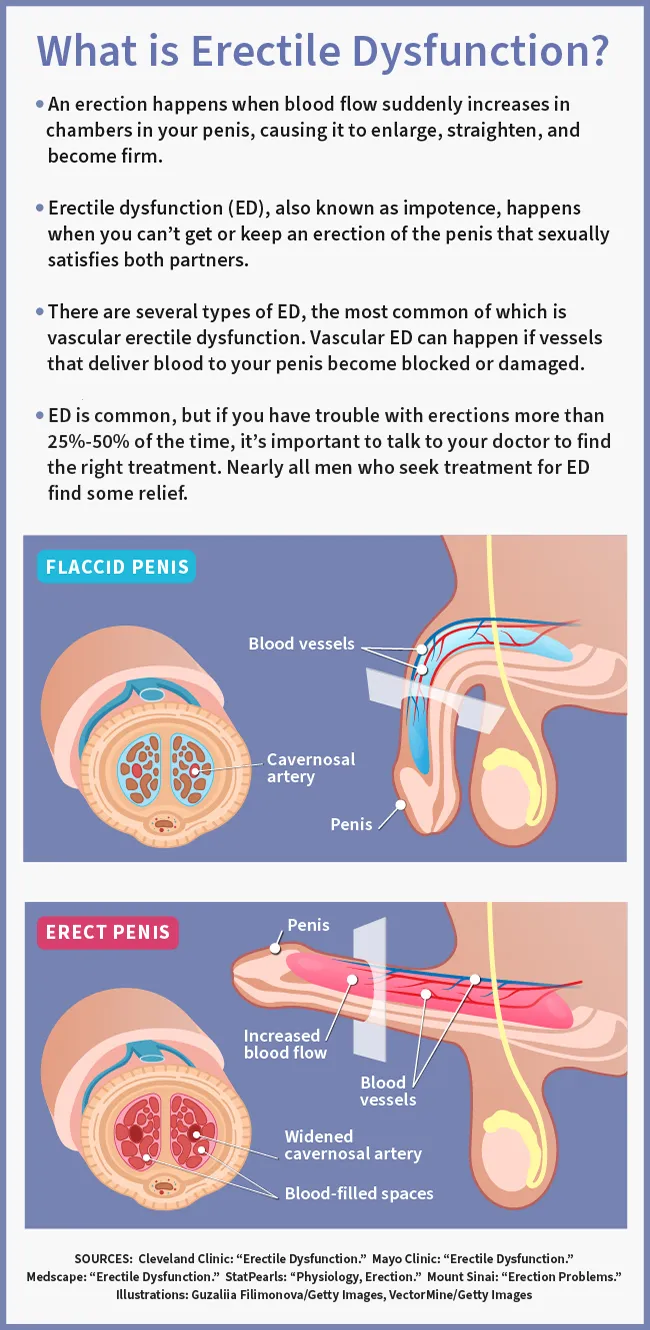 Erectile Dysfunction Treatment: A Complete Case Research