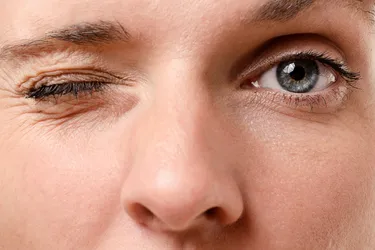 An eye twitch is an eye muscle or eyelid spasm or movement that you can't control. A?minor eyelid?twitch?is often linked to everyday things like fatigue, stress, or caffeine. (Photo credit: iStock/Getty Images)