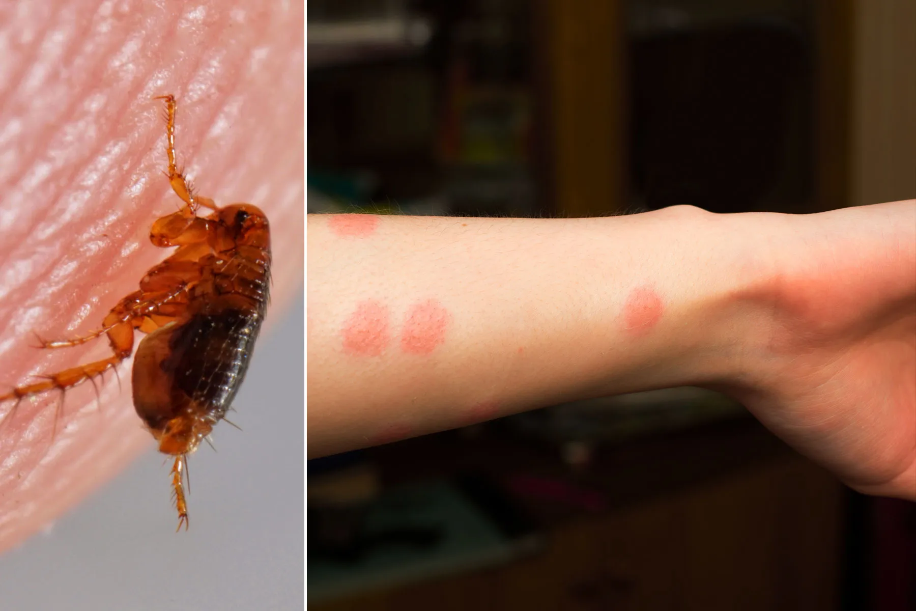 Cat Flea Bites