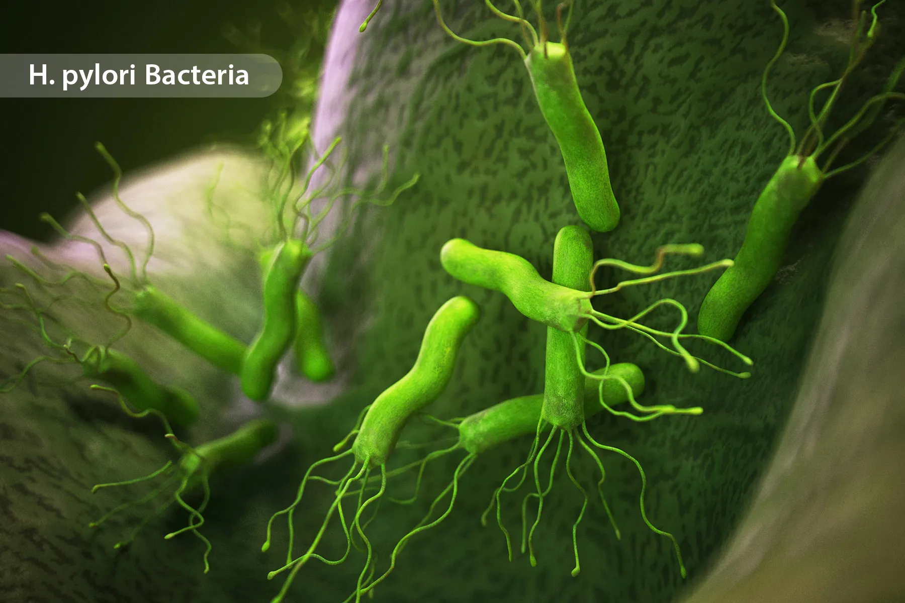 photo of H.Pylori bacteria