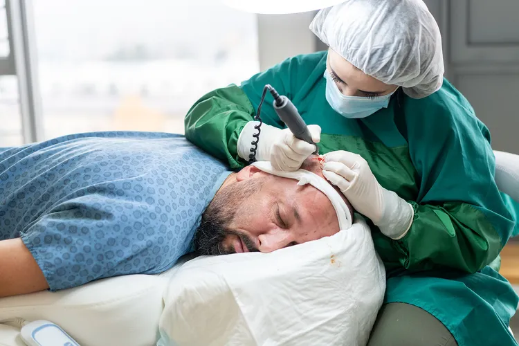 A hair transplant is a type of surgery that moves hair you already have to fill an area with thin or no hair. It's designed to be permanent. (Photo Credit: Moment/Getty Images)