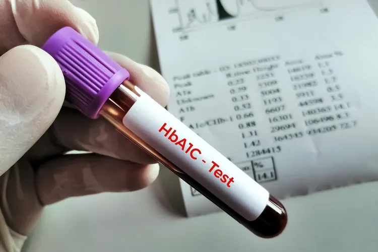 photo of HbA1c blood test