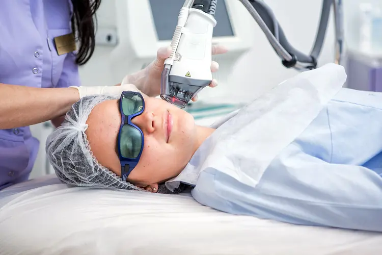 photo of IPL facial laser in use
