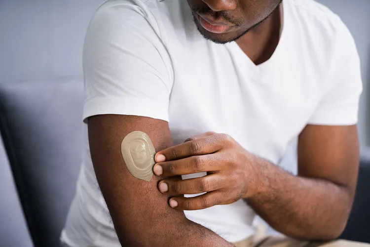 photo of man applying testosterone replacement patch to upper arm