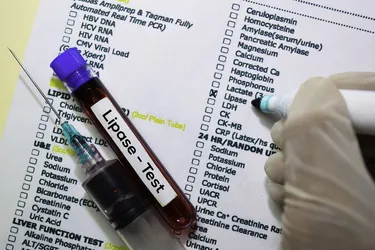 Your doctor might order a lipase blood test if you have problems with your pancreas. (Photo credit: Dreamstime)