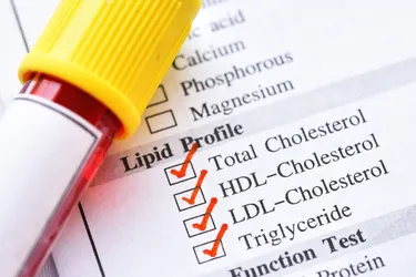A lipid profile test checks your cholesterol and triglyceride levels. (Photo credit: iStock/Getty Images)