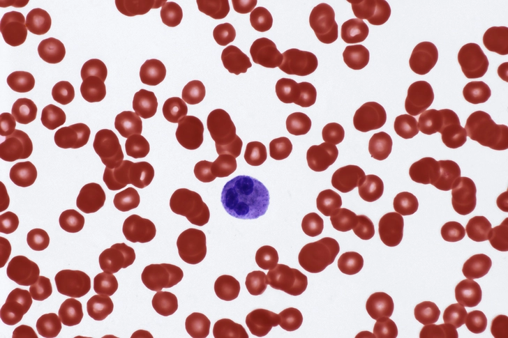 Low Blood Counts (Infection, Breathlessness, Bruising): What Doctors Can Do
