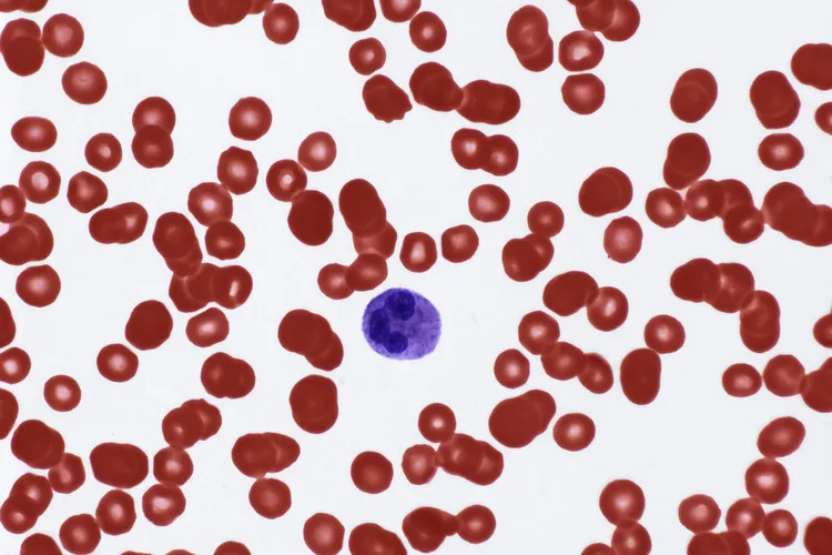 photo of low white blood cell count