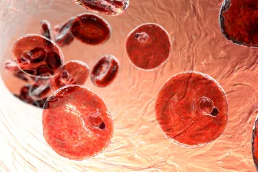 One species of parasite that can cause malaria in humans is Plasmodium malariae. This image shows P. malariae infecting red blood cells. (Photo Credit: Science Photo Library/Getty Images)