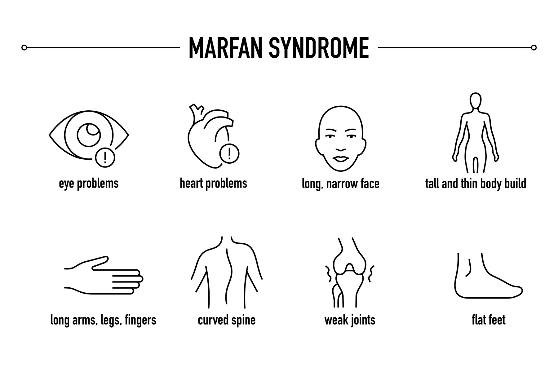 photo of marfan syndrome