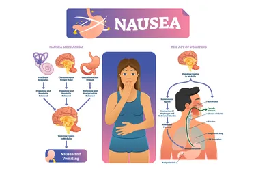 Nausea and vomiting are triggered by stimuli in the central nervous system (brain and spinal cord.) (Credit: VectorMine/Dreamstime)
