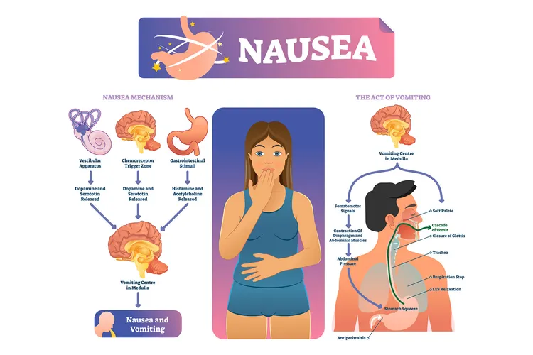 photo of Nausea and vomiting illustration