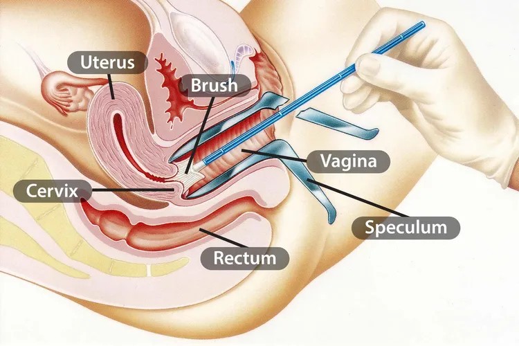 illustration of cervical smear test