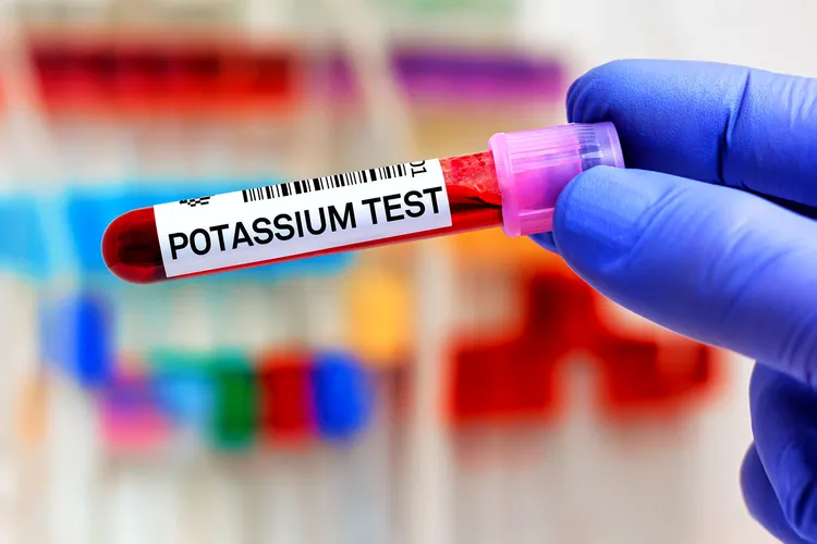photo of Potassium blood test