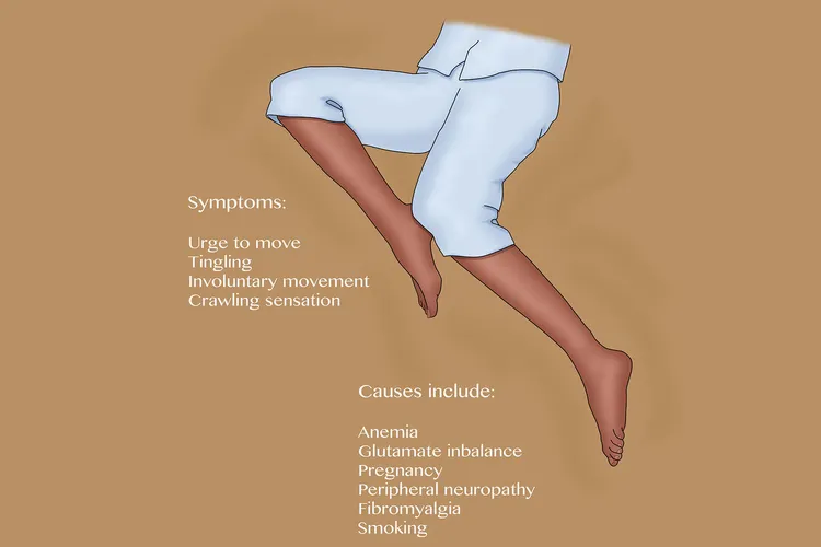 illustration of restless leg syndrome