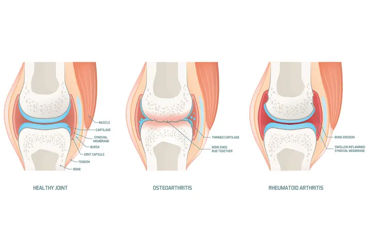 photo of joint anatomy