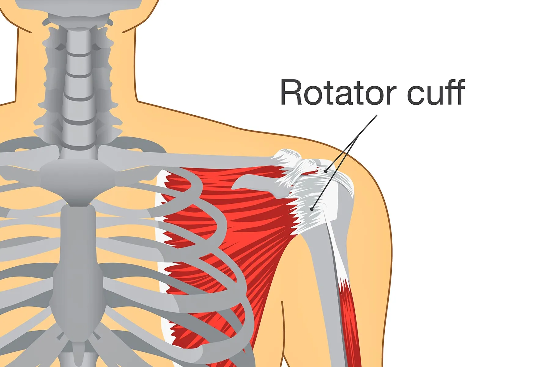 photo of rotator cuff