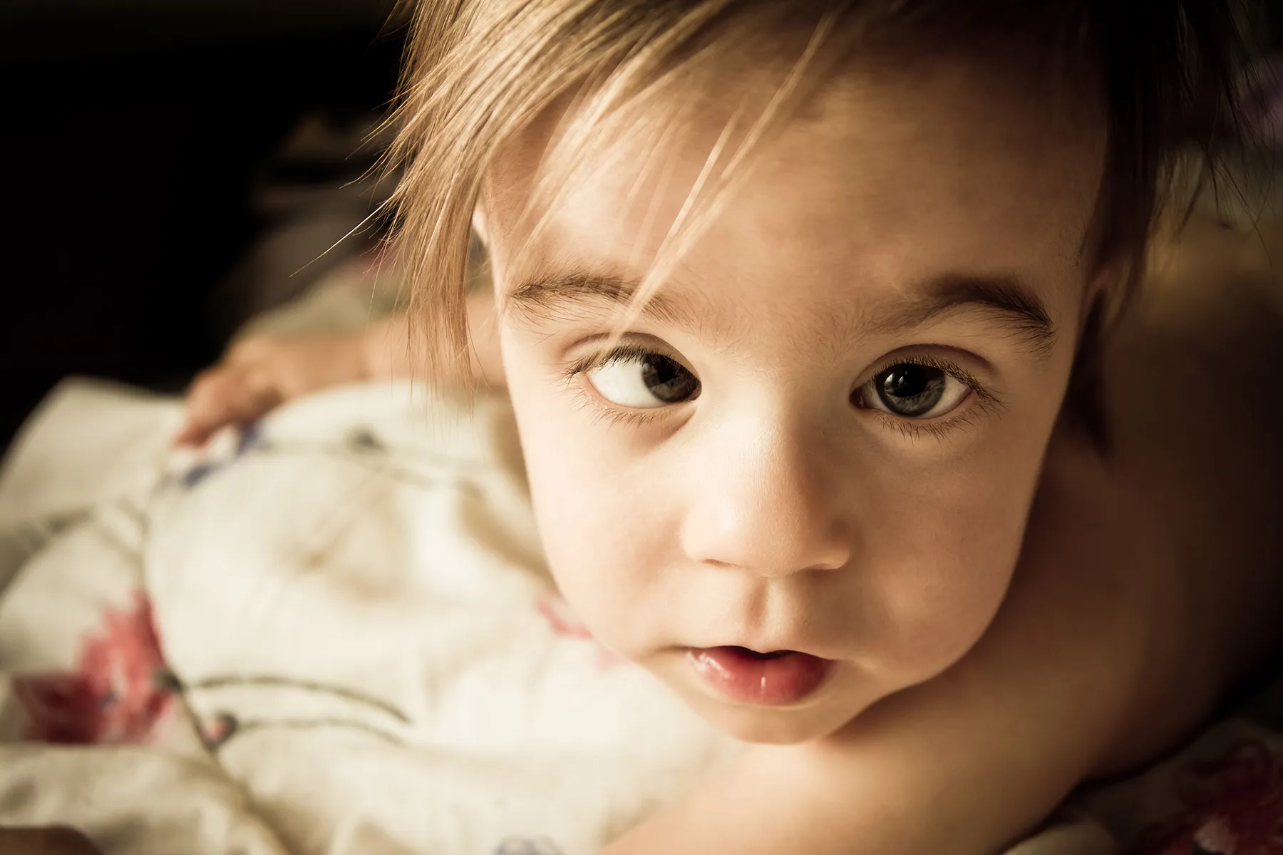 photo of child with strabismus